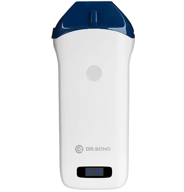 DRSONO-Portable-ultrasound-scanner-banner-image