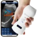 Handheld-Wireless-Ultrasound-Scanner-1