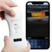 handheld-wirelss-ultrasound