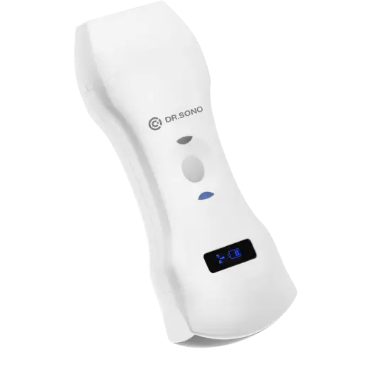 portable-ultrasound-scanner-Banner-Image-2