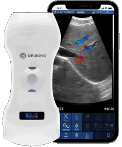 the best portable ultrasound machine