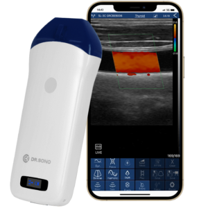 Best Portable Ultrasound Machine for Pregnancy