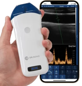 Best Portable Ultrasound Machine for Physical Therapy